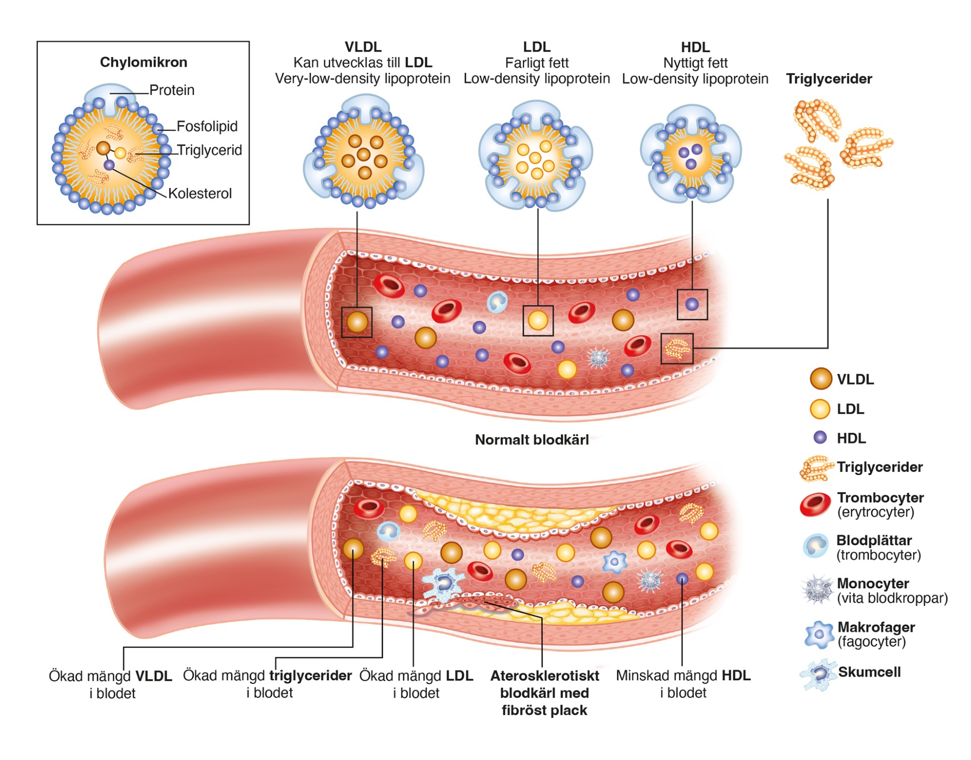 thumbnail_Lipoproteiner A variant 2 KL.jpg