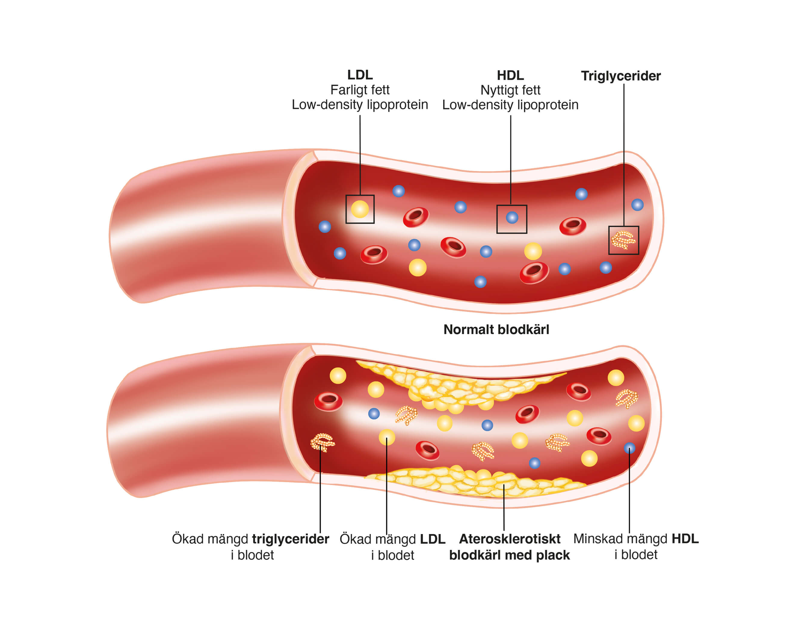 Lipoproteiner D.png